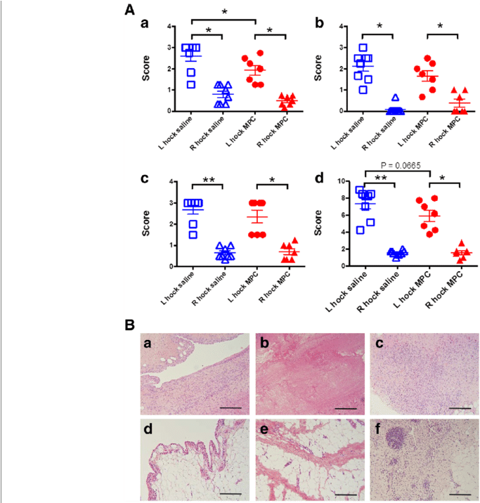 A Effect Of Mpc Treatment On Synovial Histopathology - Joint (850x715), Png Download