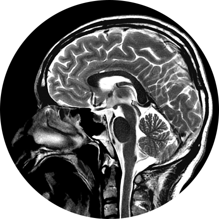 Brain, Head & Spine Imaging Image - Lmp Enfermedad (440x440), Png Download