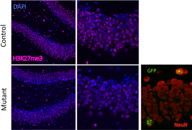Methylation Status And Mecp2-gfp Reactivation Are Shown - Xist (645x433), Png Download