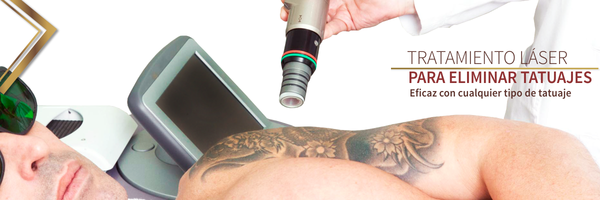 Elimina Esos Tatuajes No Deseados - Writing (1200x400), Png Download