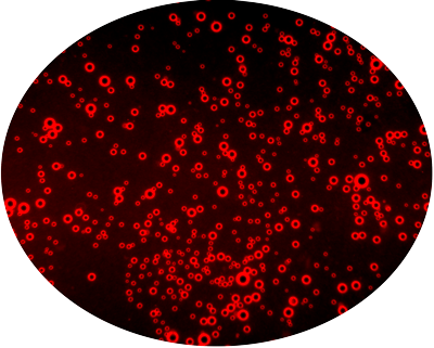 ¿cómo Actúan Las Burbujas Lipídicas - Portable Network Graphics (400x321), Png Download