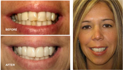 Dental Smile - Dr. Philip M. Tornatore, Dds - Dentist In Hicksville (480x273), Png Download