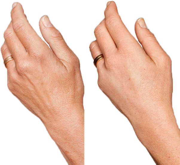 Collage Manos Def - Human (640x602), Png Download