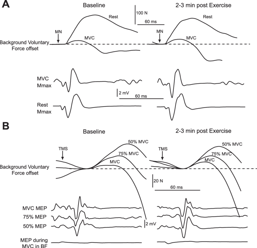 Raw Traces Of Twitch Forces And Electromyographic Responses - Force (850x821), Png Download