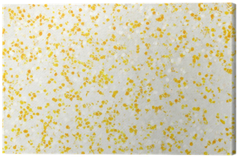 Golden Sparkle Glitter Background Canvas Print • Pixers® - Display Device (400x400), Png Download
