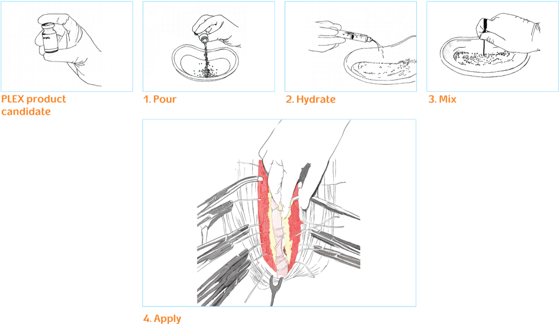 Prereration Of D-plex - Graphics (1101x652), Png Download