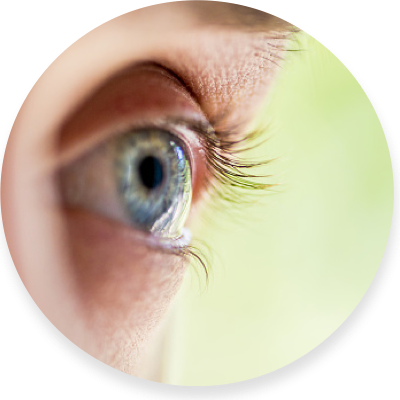 Contact Lens - Bolsa De Agua Dentro Del Ojo (400x400), Png Download
