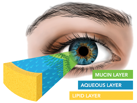 Understanding The Tear Film And Dry Eye - Dry Eye (446x336), Png Download