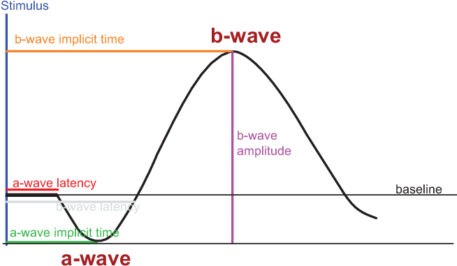 The A Wave Of The Electroretinogram Reflects The Activity - Electroretinography (653x392), Png Download