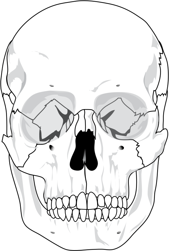 The Editing Of The Human Skull - Human Skull Blank Diagram (402x597), Png Download