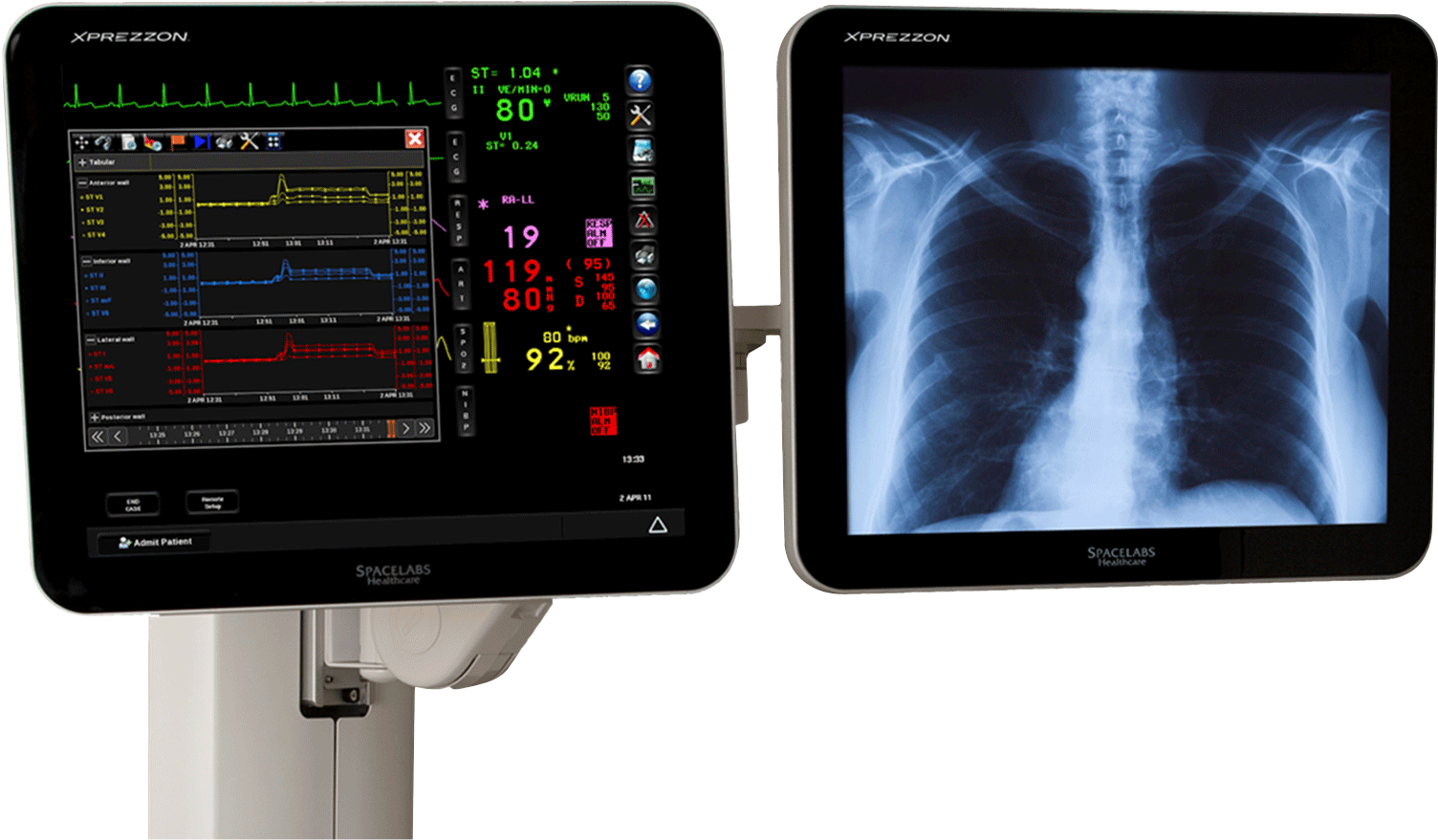 Click To Enlarge - Spacelabs Xprezzon (1557x900), Png Download