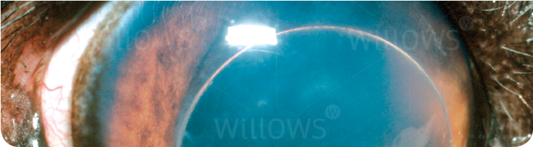 Lens Luxation - Cat (777x340), Png Download