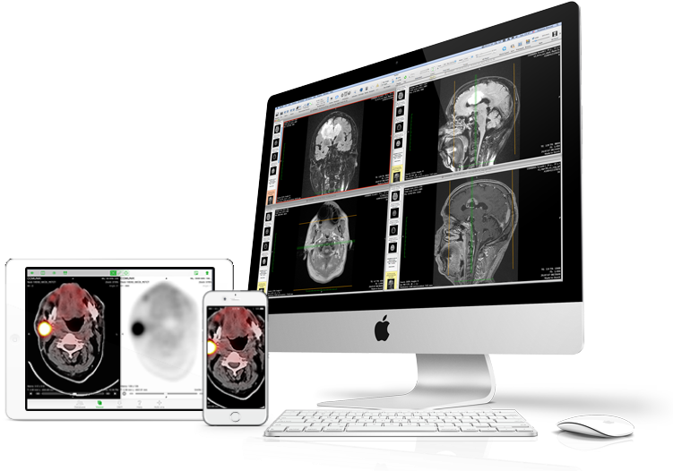 Devices-osirix - Opal Tech Solutions (764x560), Png Download