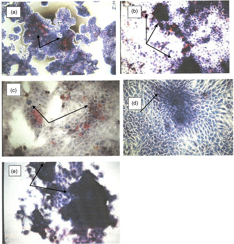 Kb Cells Were Cultured In Dmem-10% Fcs Medium For 5 - Visual Arts (903x781), Png Download