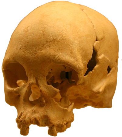 National Museum Of Brazil Skull (414x473), Png Download
