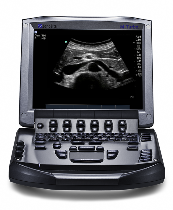 Sonosite M-turbo® Ultrasound System - M Turbo (585x710), Png Download