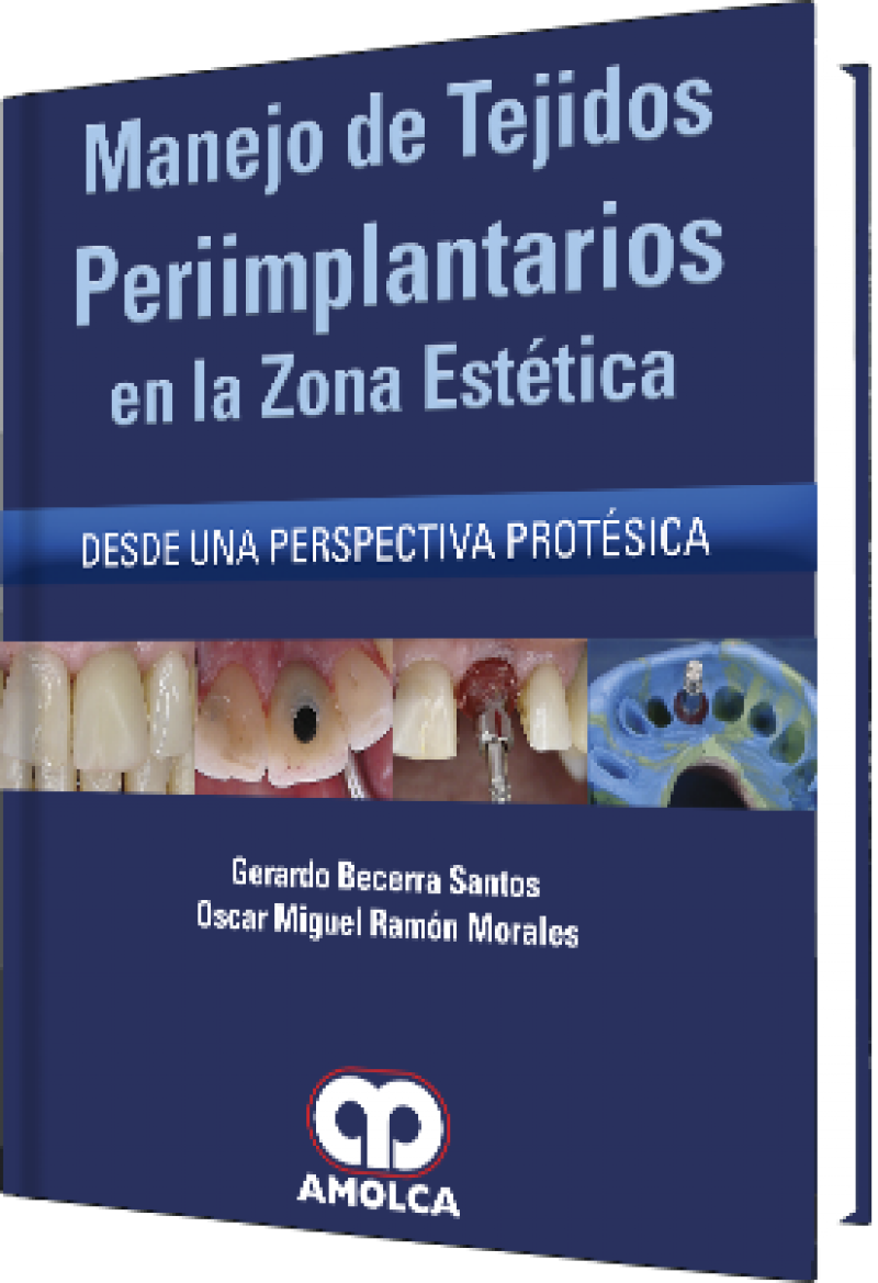 Manejo Tejidos Periimplantarios En Zona Estetica - Surgery (800x1169), Png Download