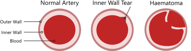 What Is Scad - Circle (669x185), Png Download