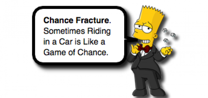 Pediatric Chance Fractures - Chance Fracture (720x340), Png Download