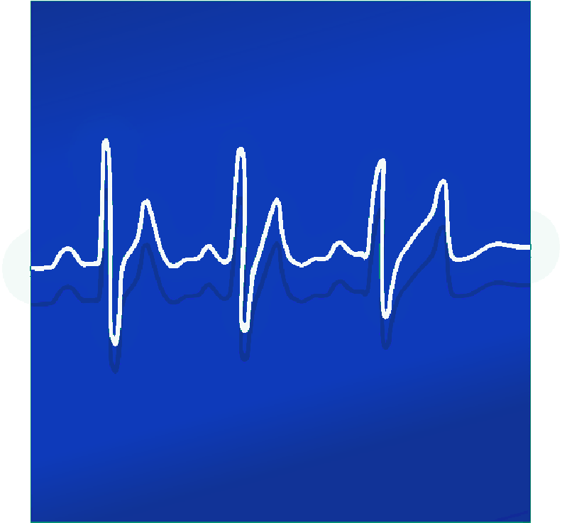 Mb Image/png - Electrocardiography (800x736), Png Download
