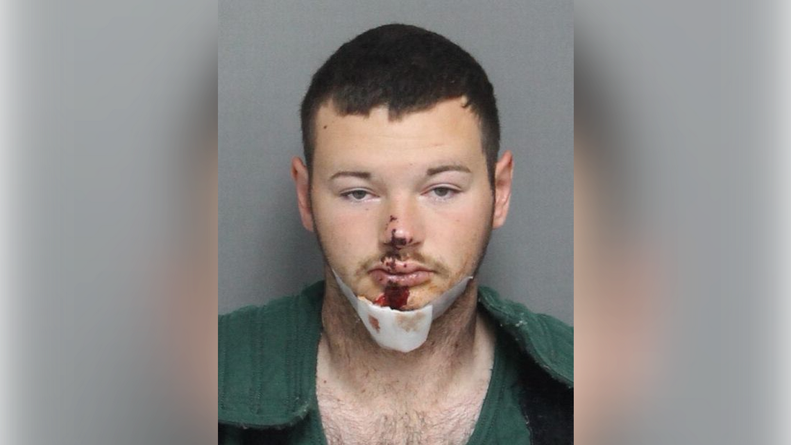 Sc Man Killed Horse, Shot Himself In The Face With - Maniac Face (1140x641), Png Download