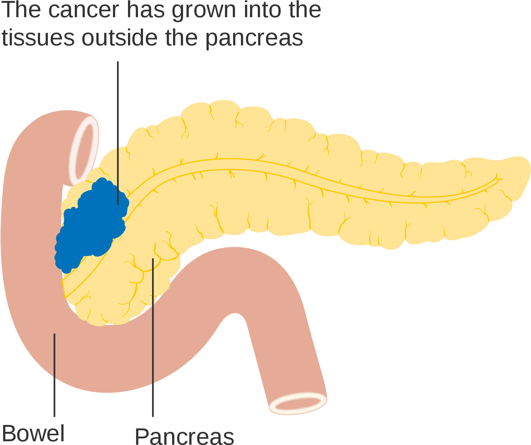 Open - Pancreas Diagram Png (2000x1707), Png Download