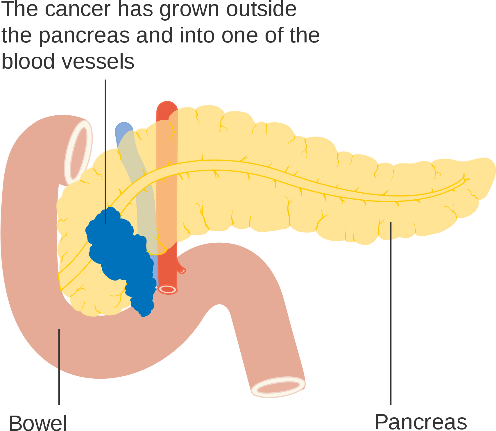 Open - Humboldt Clothing Company (2000x1712), Png Download