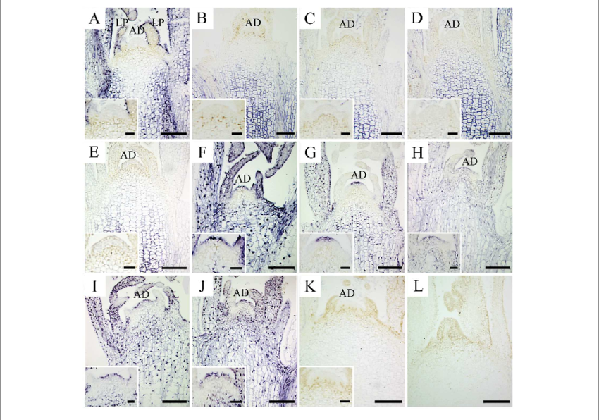 In Situ Localization Of Csvd In Infected In Vitro Culture - Shoot (850x596), Png Download