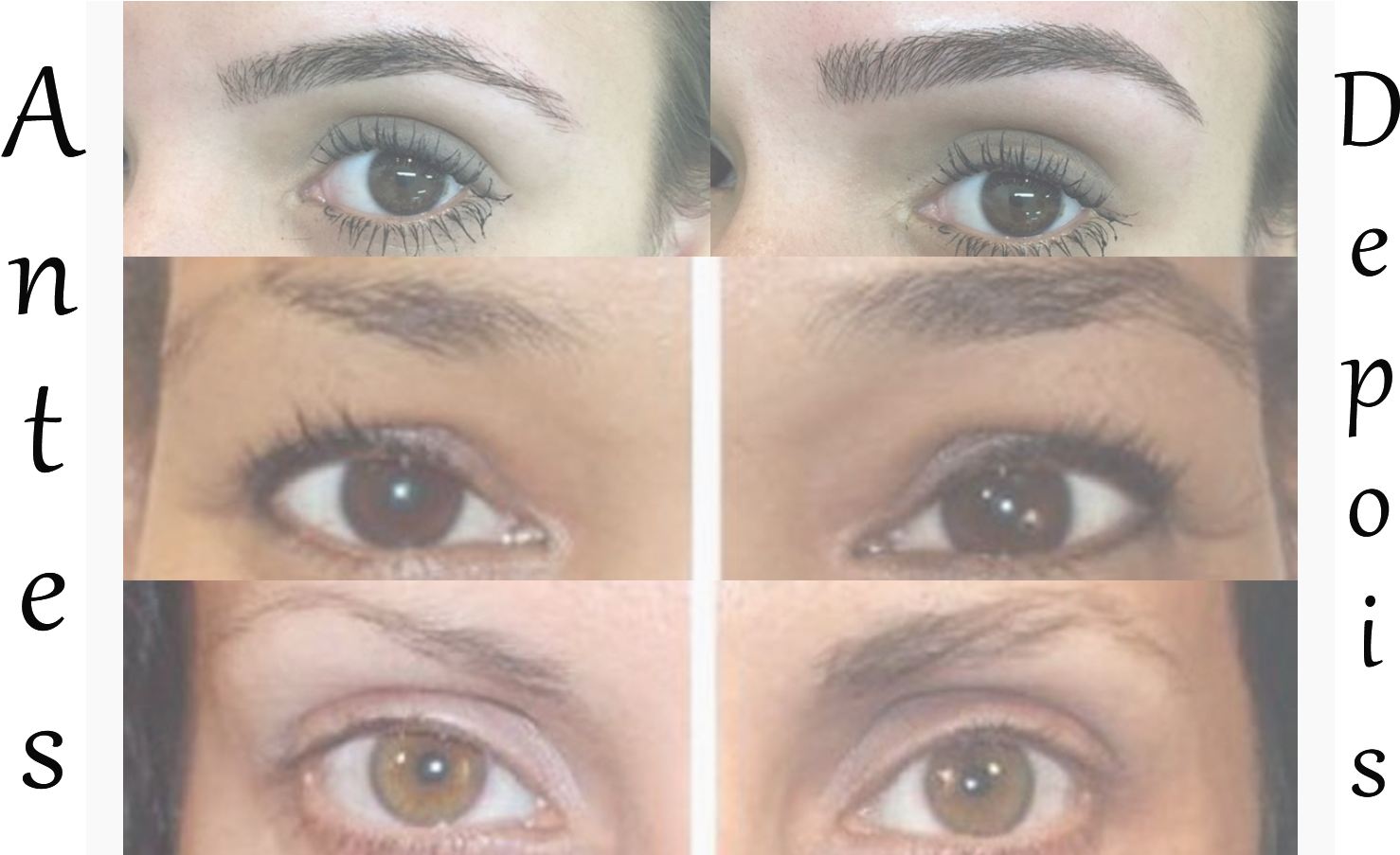 Como Fazer A Sobrancelha Falhada Crescer - Eye Liner (1564x902), Png Download