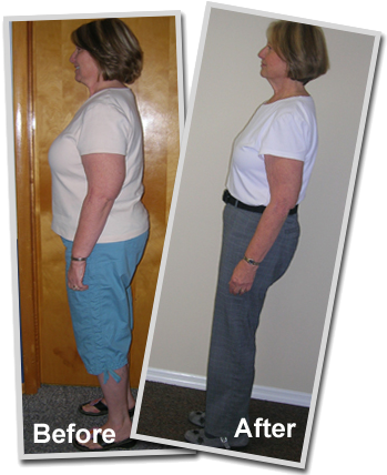 Hcg Before And After Weight Loss Pictures Pat - Hcg Success Stories (355x435), Png Download