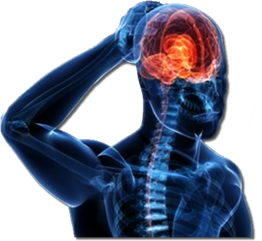 Head Injury - Brain Concussion Png (382x352), Png Download