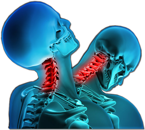 Whiplash Injury (580x521), Png Download