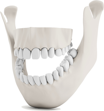 Illustrated Full Mouth Reconstruction In Austin Tx - Tmj Treatment (350x374), Png Download