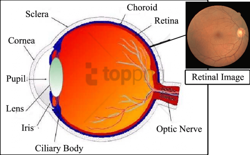 Human Eye Cross-sectional View With An Example Of A - Cross Sectional View Of Eye (749x465), Png Download