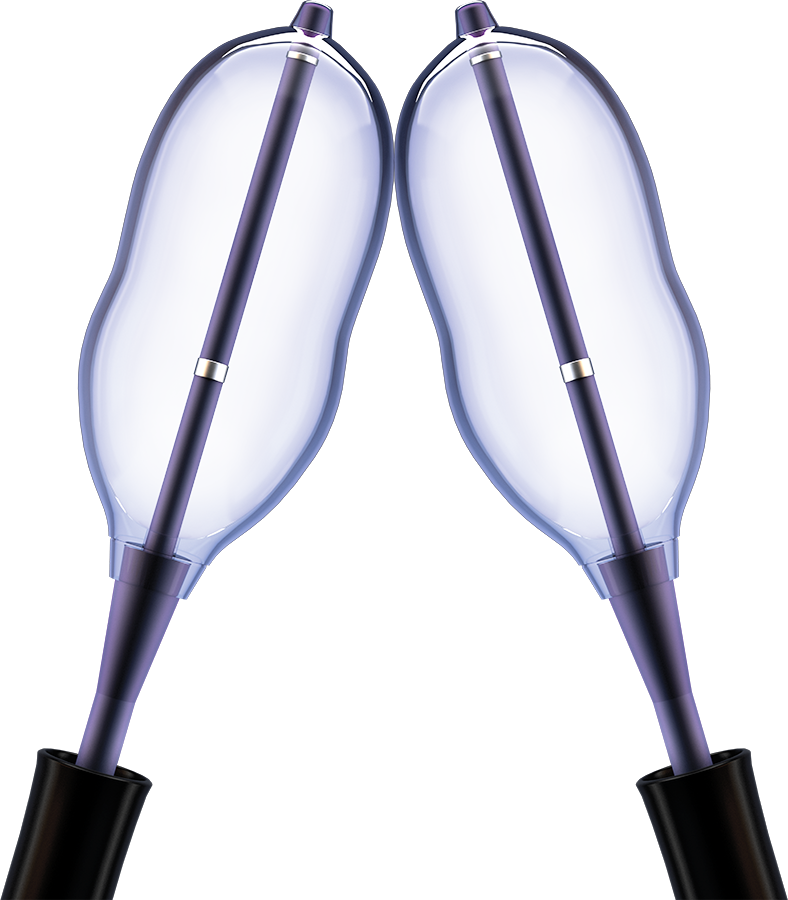 Png Two Kyphon Balloons - Percutaneous Vertebroplasty (788x900), Png Download