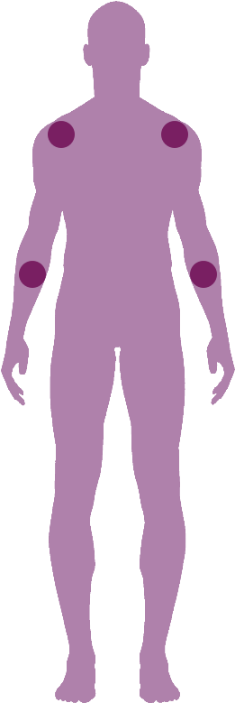 Arm Pain - Pain (612x792), Png Download