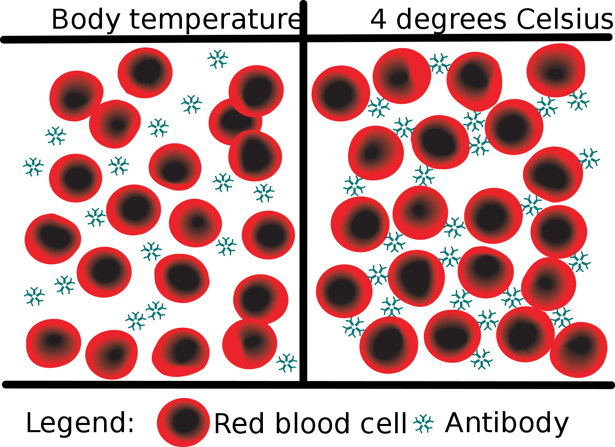Heterophile Test (1200x873), Png Download