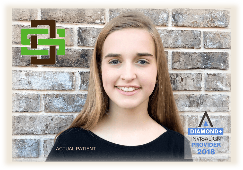 View Our Video Blogs - Spillers Orthodontics (1000x703), Png Download