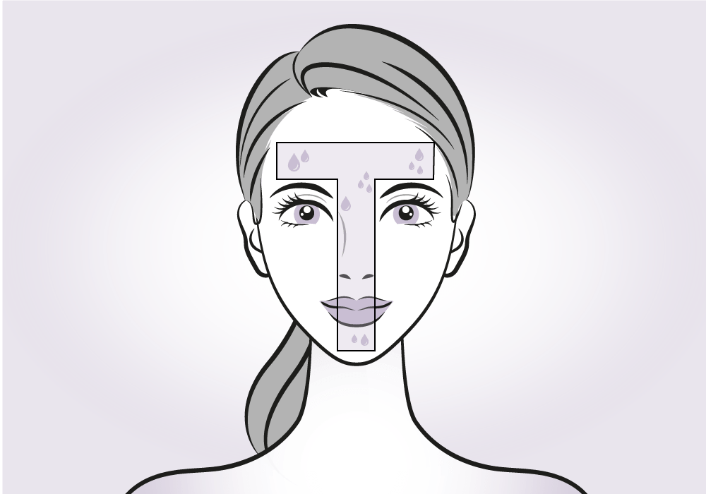 What Happens During The Procedure - Illustration (1000x700), Png Download