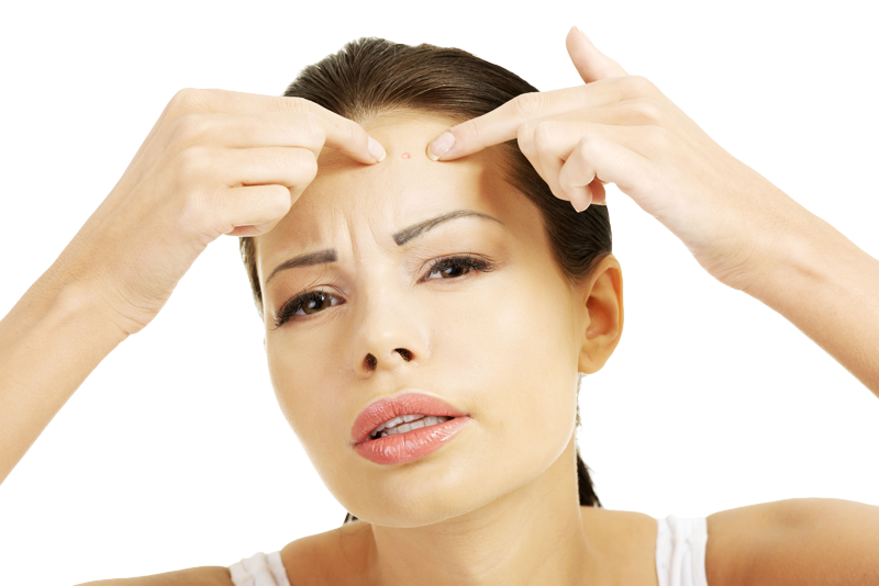 You Have A Giant Fucking Zit - Skinosm Pimple Popper Tool Curved Tweezers Metal Blackhead (800x534), Png Download