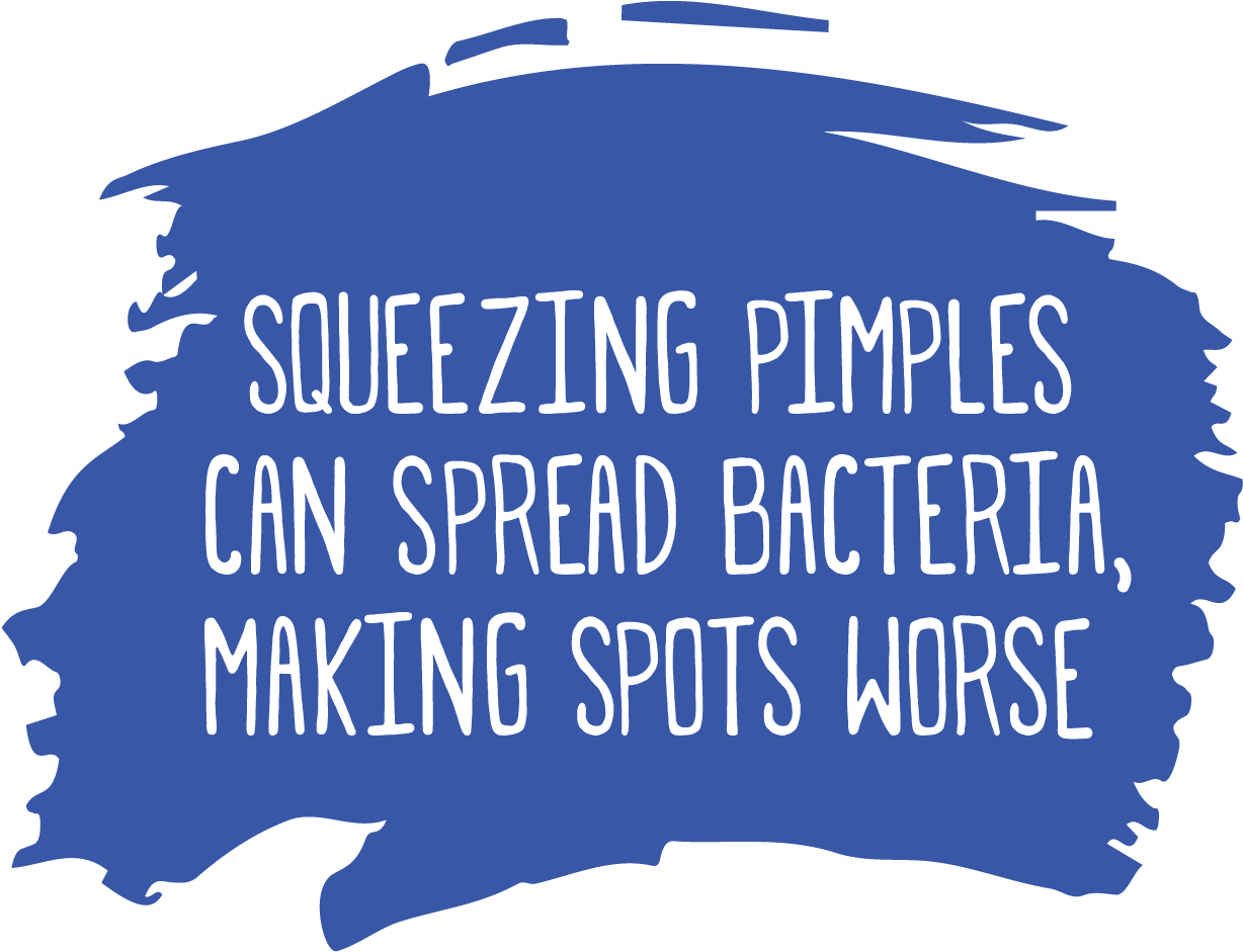 Squeezing Pimples Can Spread Bacteria, Making Spots - Acne (1260x1020), Png Download