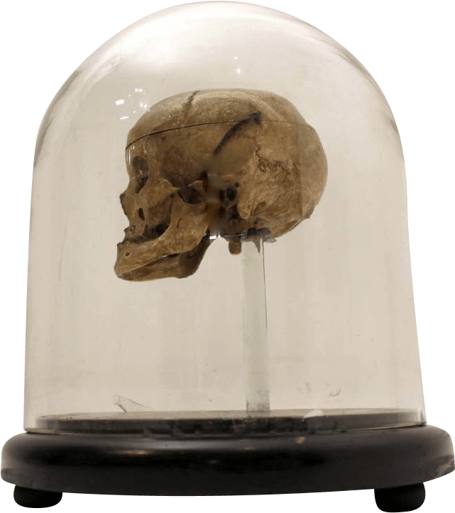 18th Century Human Skull In A Victorian Glass Dome - Skull (900x827), Png Download