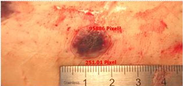 Determination Of The Area Of The Bruise In Pixel2 After - Blood (902x296), Png Download