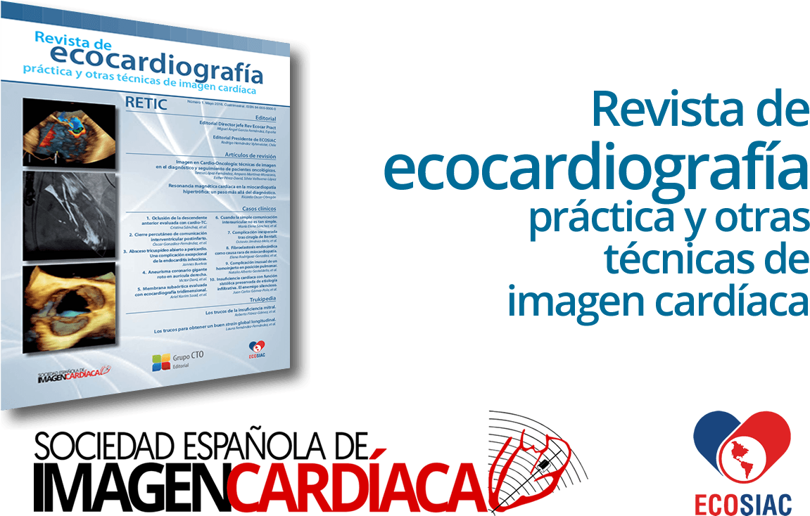 Revista De Ecocardiografía - Magazine (1171x757), Png Download