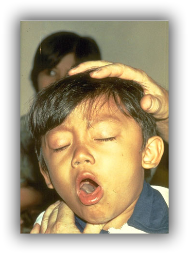 Whooping Cough (389x521), Png Download