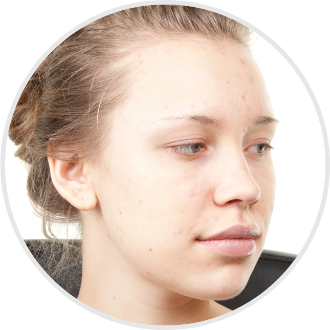 60 Minutes / Recommended 10 Sessions - Girl (645x644), Png Download