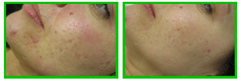 Before And After - Baby (800x270), Png Download