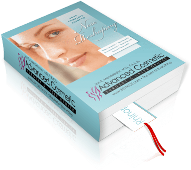 Rhinoplasty Animation Videos - Rhinoplasty (494x400), Png Download