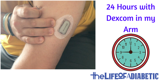 24 Hours With A Dexcom Arm Site - Dexcom G6 On Arm (560x315), Png Download