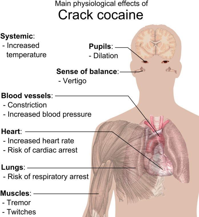 Physiological Effects Of Crack Cocaine - Effects Of Crack Cocaine (709x768), Png Download